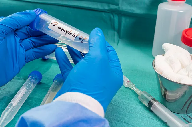 Nouveau traitement contre la maladie d’Alzheimer : l’avis du Dre Panchal