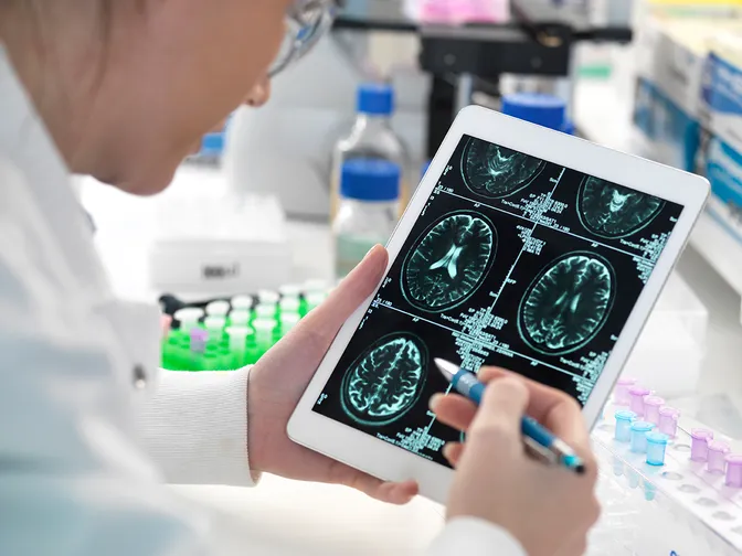 L’intelligence artificielle pour un dépistage précoce de la maladie d’Alzheimer